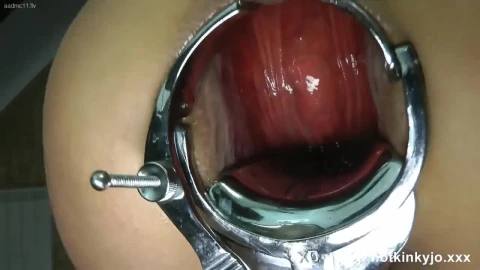 Huge Speculum And Deep Dildo Fuck Movie